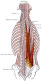 Erector spinae (back muscle) trigger point